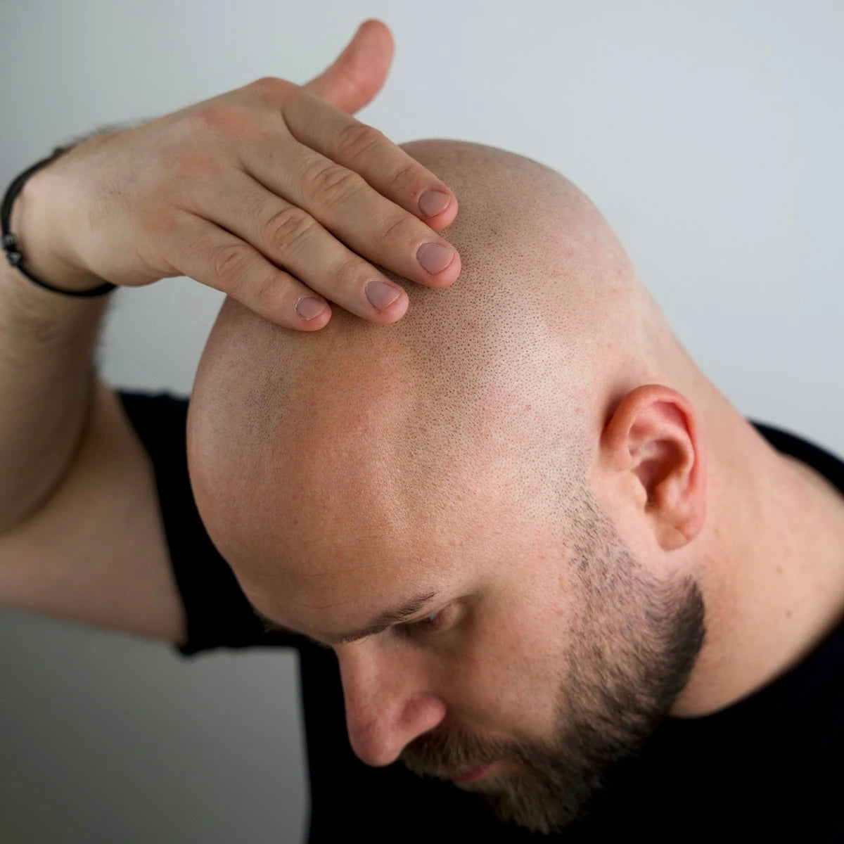 Midnight Recovery & Repair Bald Serum (0-6 mm.), 30 ml.