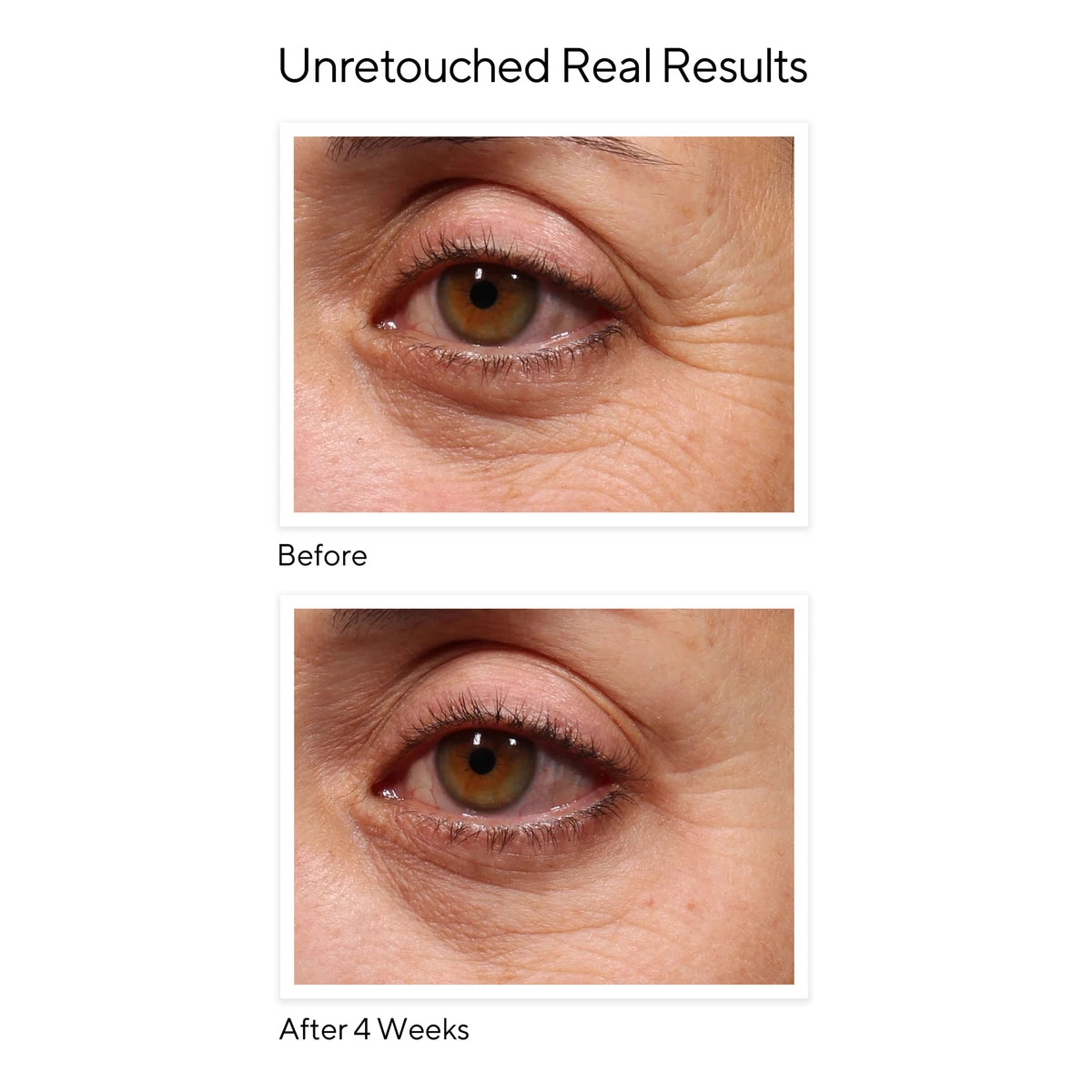 Retinol Youth Renewal Eye Serum, Resurgence, 15 ml.