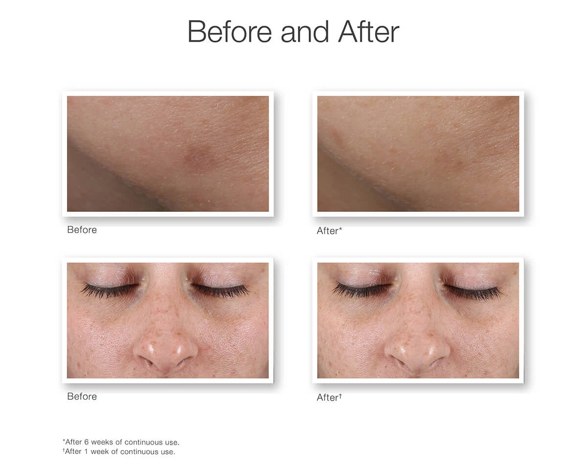 Rapid Age Spot Correcting Serum, Environmental Shield, 30 ml.