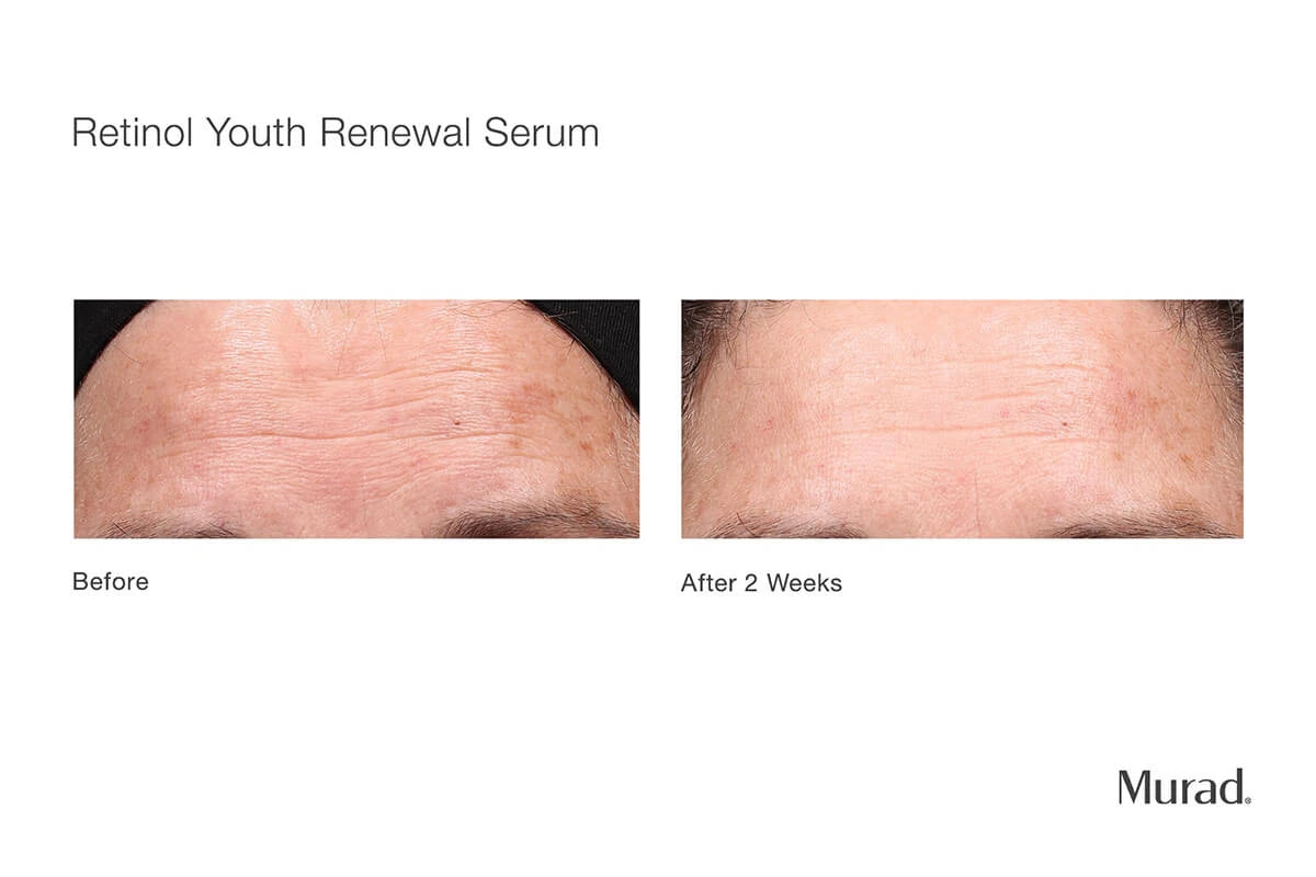 Retinol Youth Renewal Serum, Resurgence, 30 ml.