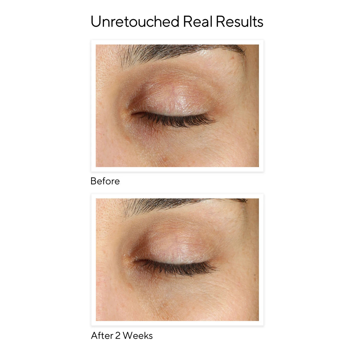 Vita-C Eyes Dark Circle Corrector, Environmental Shield, 15 ml.