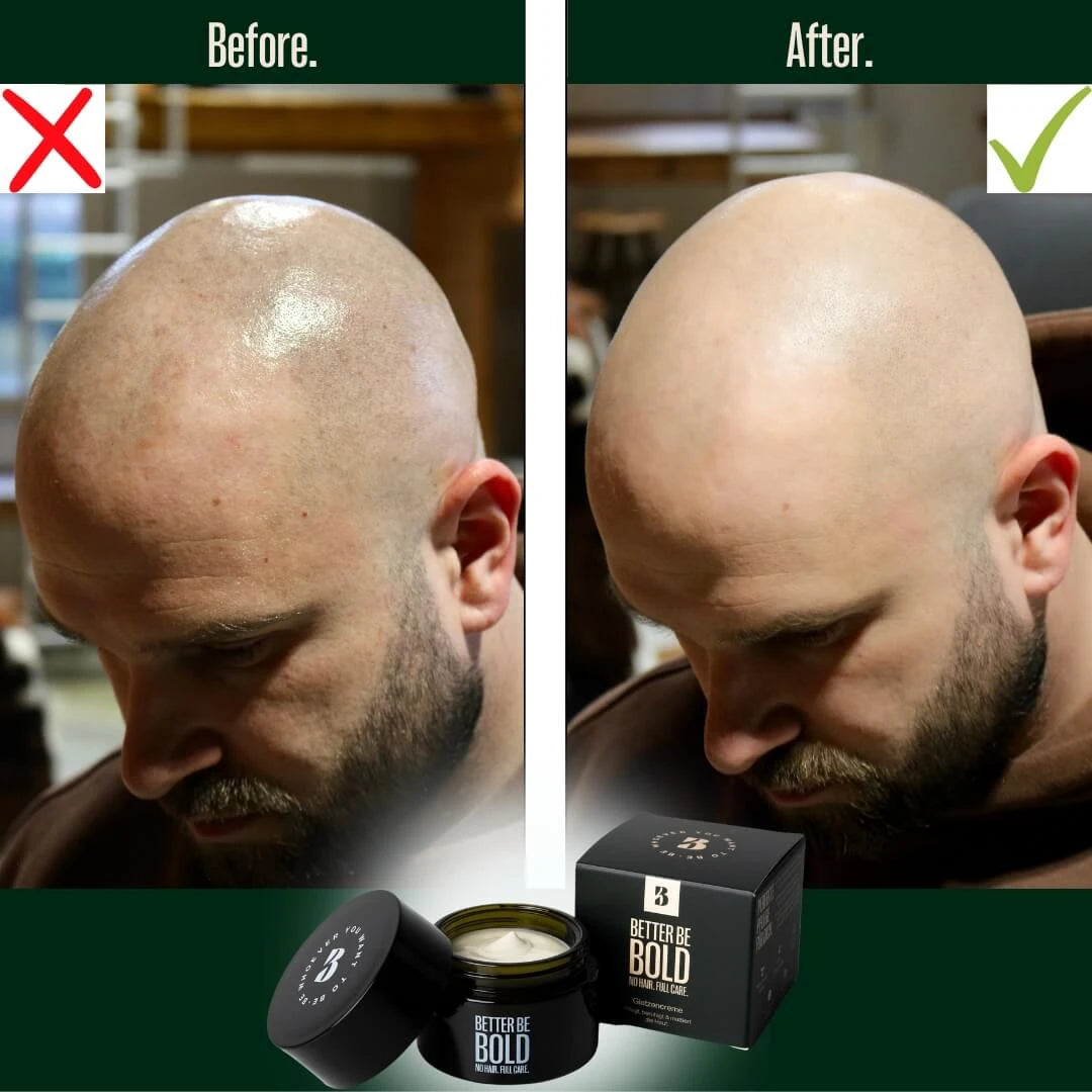 Moisturizing Bald Cream (0-3 mm.) - Matt Effect, 50 ml.