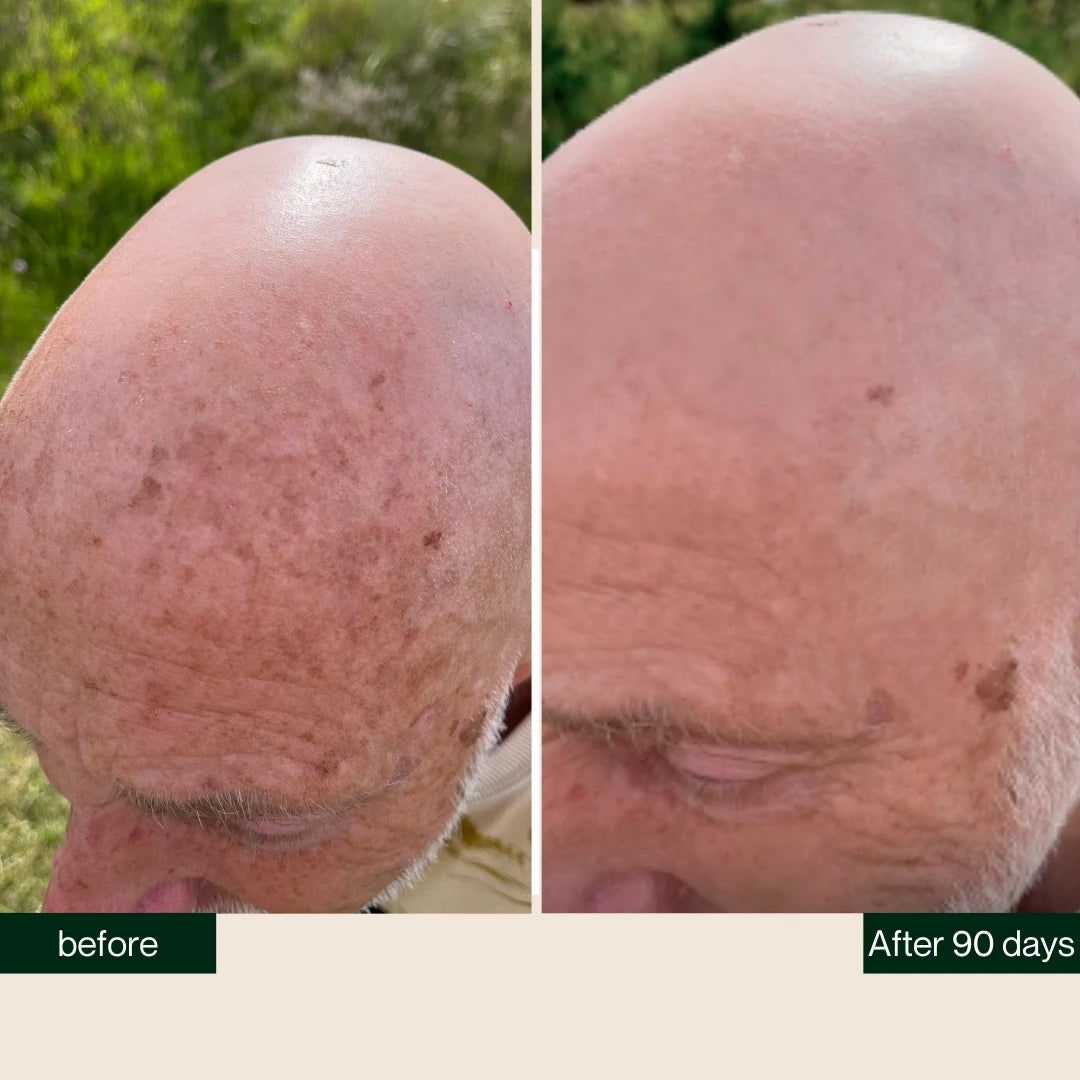 Midnight Recovery & Repair Bald Serum (0-6 mm.), 30 ml.